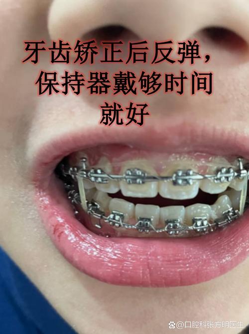 39岁牙齿矫正有效果吗_效果牙齿矫正有什么好处_效果牙齿矫正有用吗