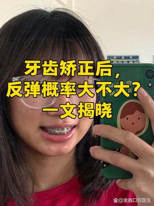 上海19岁做牙齿矫正晚不晚 过来人告诉你真实经历