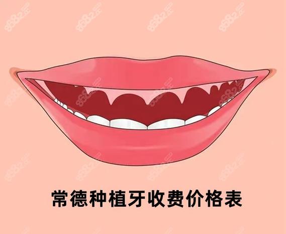上海常德半口种植牙费用2026大概多少钱?真实价格参考