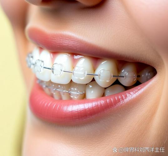 上海深圳隐形牙齿矫正价格是多少？多少钱能搞定？